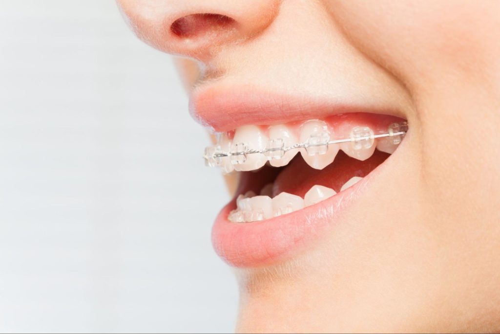 Can Orthodontics Help with Sleep Issues?