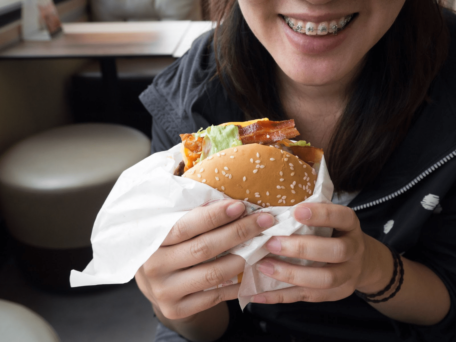 What to Eat After Getting Braces